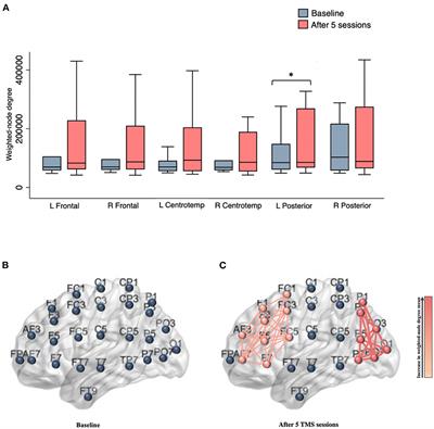 Examining the neural mechanisms of rTMS: a naturalistic pilot study of acute and serial effects in pharmacoresistant depression